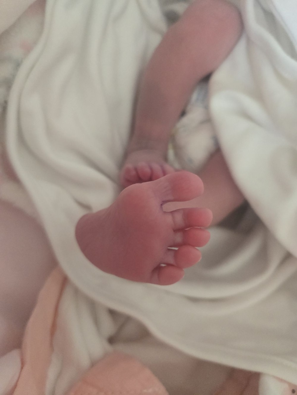 A glimpse of Nagaland’s first IVF baby, born at Putuonuo Hospital in Kohima on October 15. (Photo Courtesy: Putuonuo Hospital)